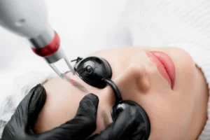 Laserowe usuwanie makijażu permanentnego w Kosmet Beauty