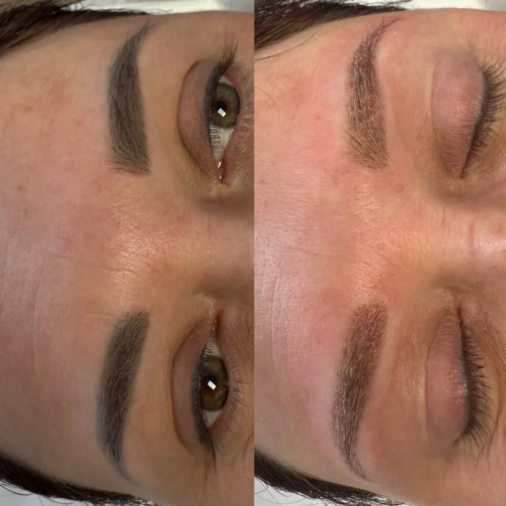 Efekty po zabiegu usuwania makijażu permanentnego w Kosmet Beauty w Koszalinie