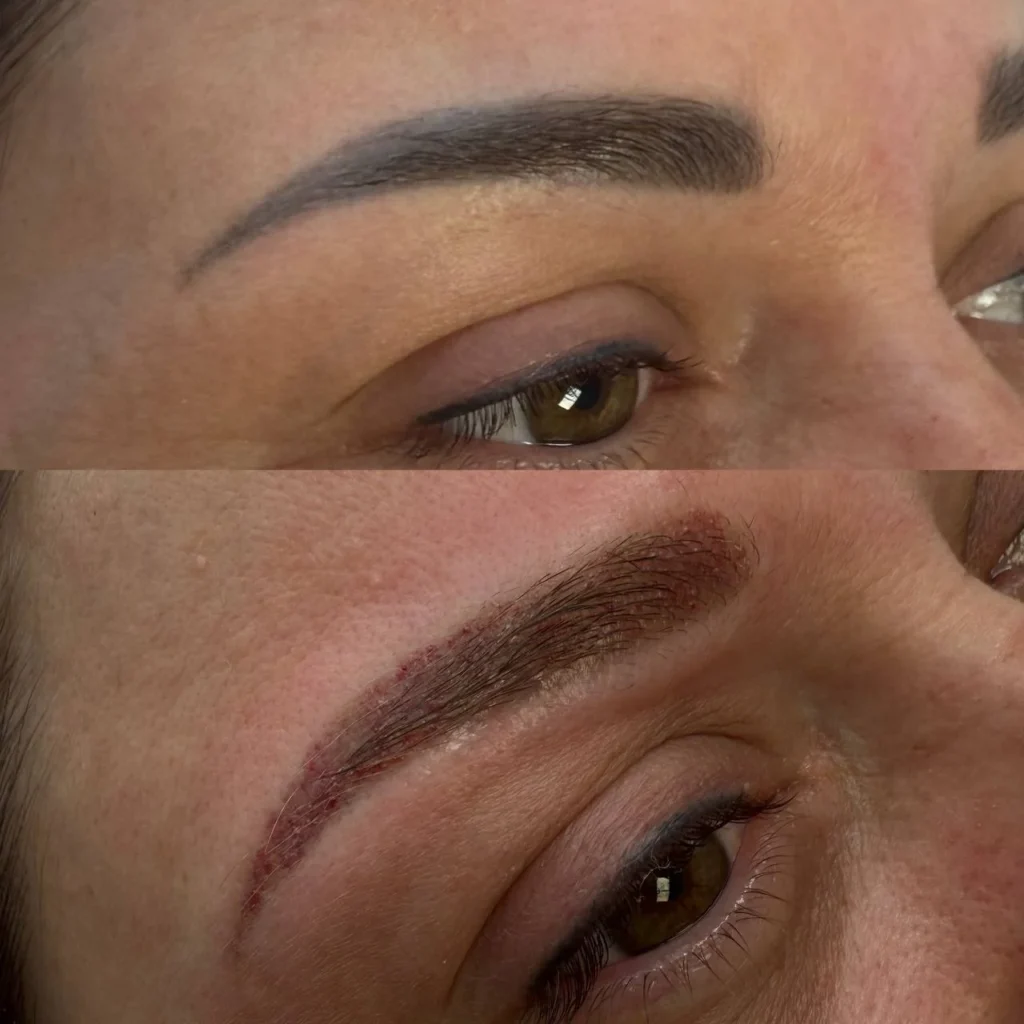 Efekty po zabiegu usuwania makijażu permanentnego w Kosmet Beauty w Koszalinie