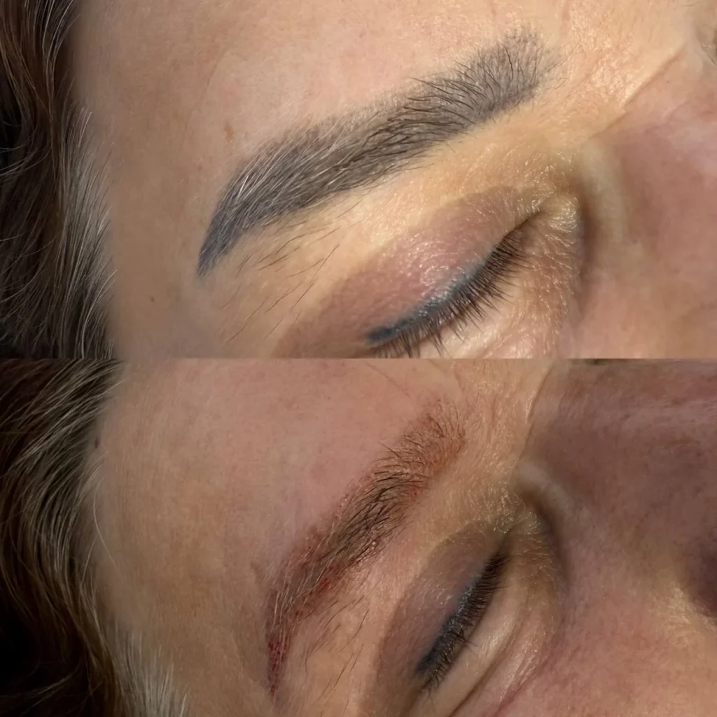 Efekty po zabiegu usuwania makijażu permanentnego w Kosmet Beauty w Koszalinie